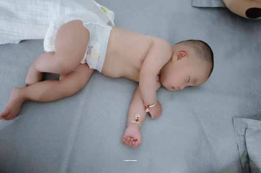 黔东宝宝头上长痱子